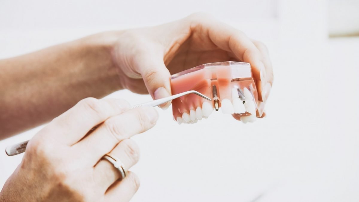 How Long Do Dentures Last, and Are They Right for You? Dentist Orangevale CA Cosmetic