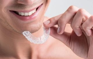 Invisalign (1)