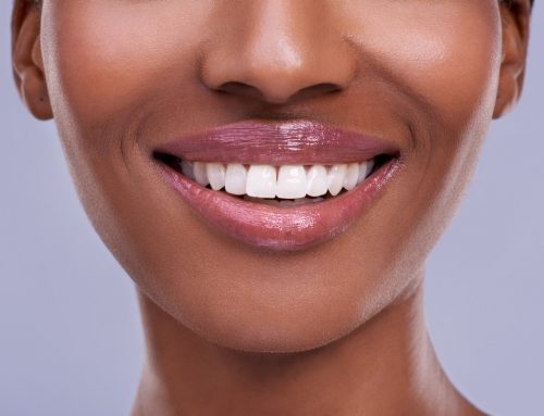 Why Do I Have a Gummy Smile? Is It Something I Was Born With?