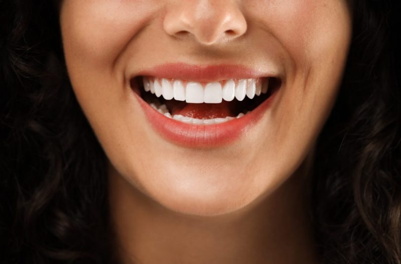 cosmetic-dentistry-1068x702