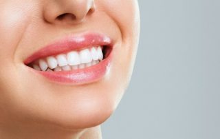 teeth-whitening-1068x777